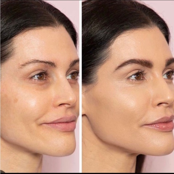 Doll10 Hydra Balm Precision Concealer in Medium BNIB - Picture 9 of 9